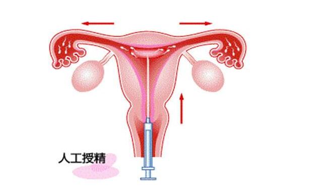 孕妇瑜伽