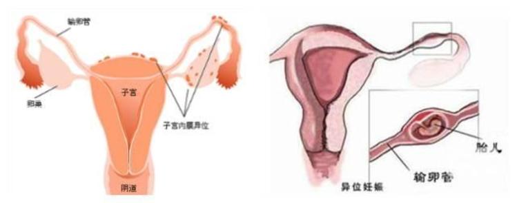 怀孕