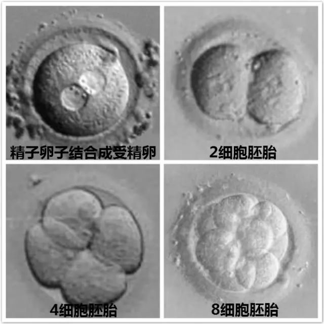 脑瘫婴儿