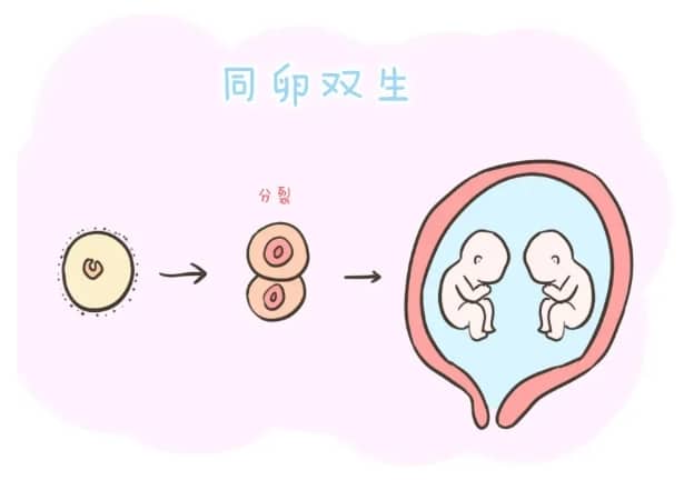 早产儿