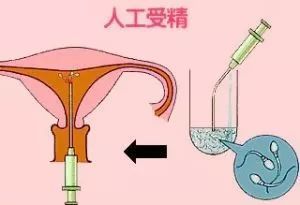 土地产权制度