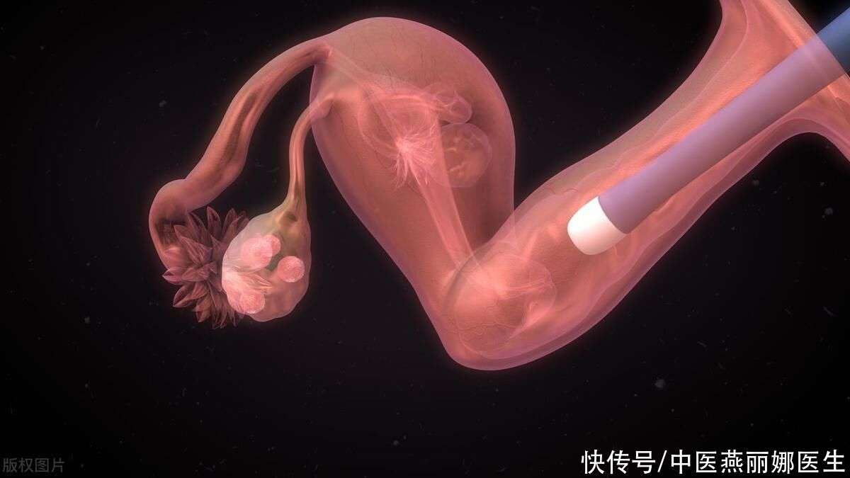 42岁女性