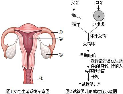 高龄产妇