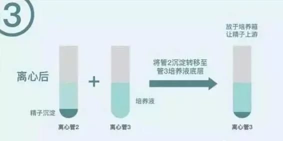 胎儿发育