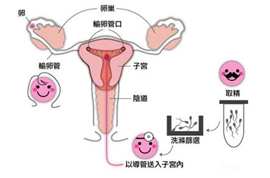 4个月胎儿有多大