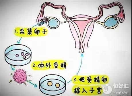 女性怀孕