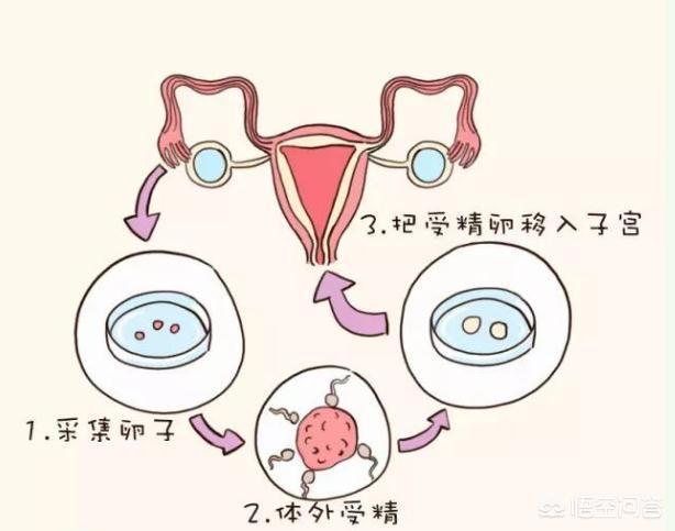 泰国试管医院