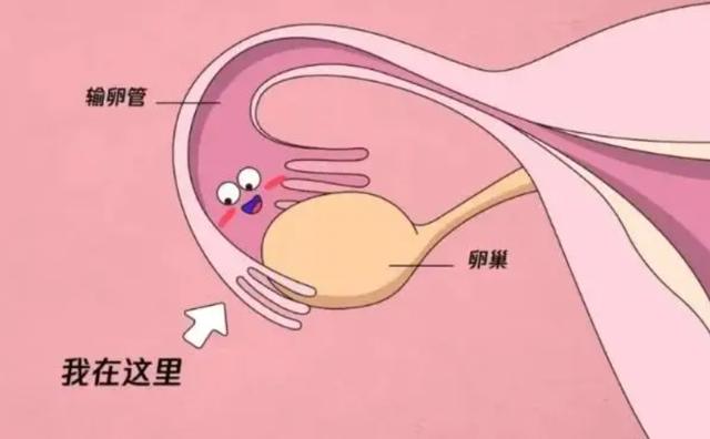卵子捐赠