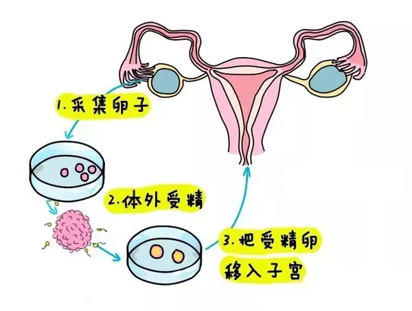 北京捐卵